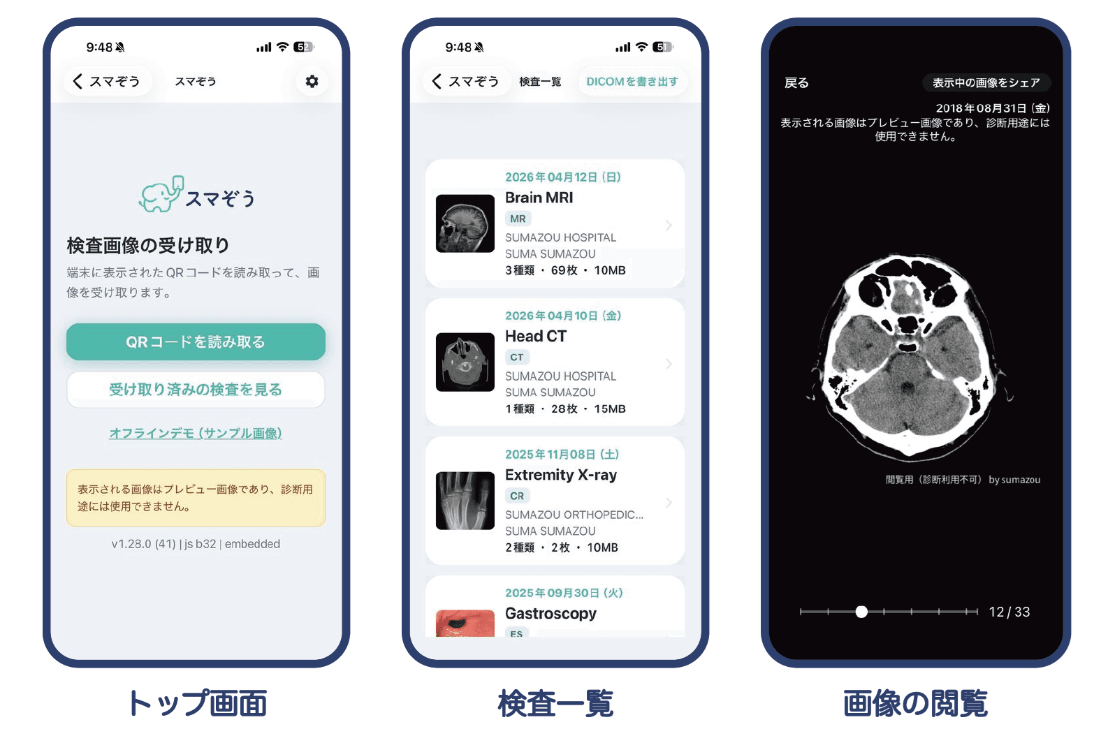 スマぞうアプリ(トップ画面/検査一覧/画像の閲覧)